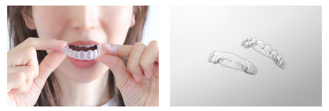 マウスピースタイプの矯正装置